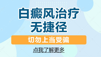 遗传性的白斑用什么方法能治好