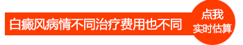 308激光照白癜风是按照什么标准收费的