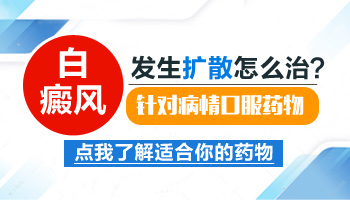 眼睛周围的白癜风出现扩散现象怎么办