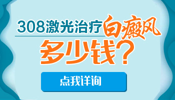 白癜风照308激光一共多少钱