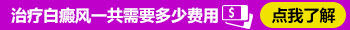 美国308激光照白癜风2019年收费标准