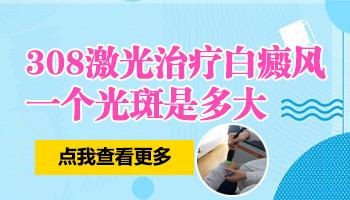 308激光照白癜风一平方厘米是多少个光斑