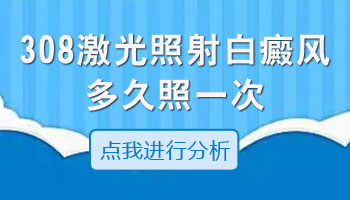 肚子上的白癜风可以照国产的308吗