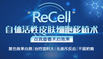 recell是什么疗法 治疗白癜风贵吗