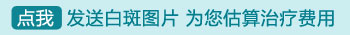 2019照308激光白斑价格表