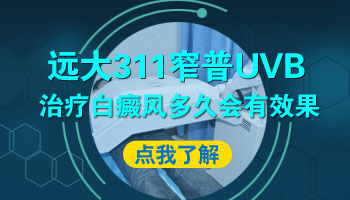 白癜风扩散期可以照uvb吗 一周照几次