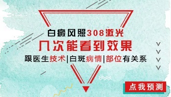 308照白癜风几次会好 照了有点粉粉的红正常吗