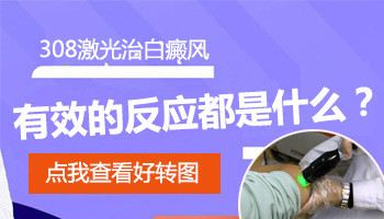 白癜风照射308激光照到什么程度比较好