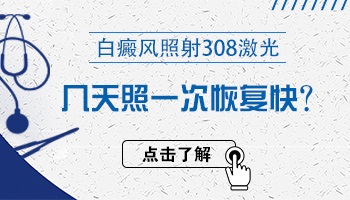 白癜风可以连着两天照光吗 有什么影响吗