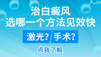 手指上有淡白色的白癜风可以照光吗