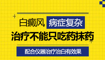 如果白癜风不去医院治自己吃药能控制住吗