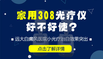 家用光疗仪多少钱 哪个牌子的能治好白癜风