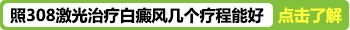 白癜风308光疗仪多少钱一台