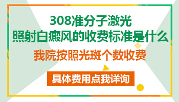 激光308收费标准是什么 光疗能治好白癜风吗