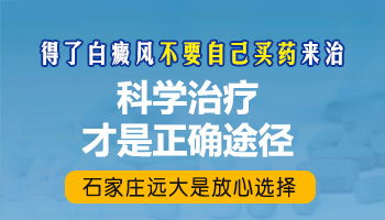 白癜风抹药后边界清晰感觉更白了