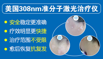 点阵激光和308哪个治疗白癜风好