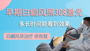 白癜风早期可以使用308准分子激光吗