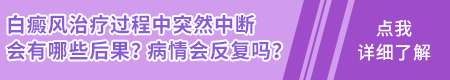 308准分子激光治疗白斑怎么样