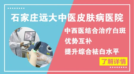 进口308准分子激光照白斑优势