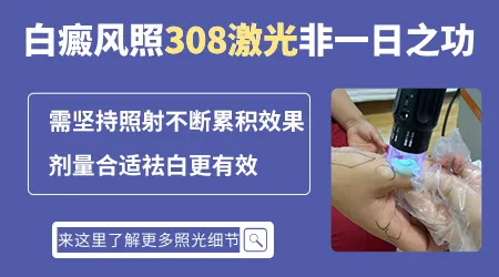 308激光照白癜风照到什么程度停止