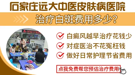 白癜风治疗费用是不是特别高