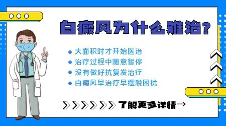 绿豆大小的白斑用什么方法治