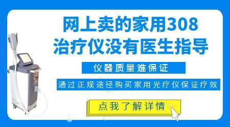 网购买的308照射白癜风靠谱吗