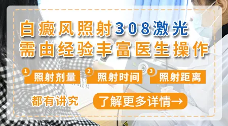 308激光治疗白癜风一次照几秒