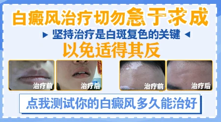 网上购买的光疗仪治疗白斑效果如何