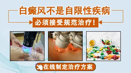 白癜风可以买家用光疗机在家照吗