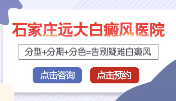 遗传性的白癜风全身都有还治得好吗