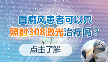 白癜风治疗只做308激光不用药可以吗