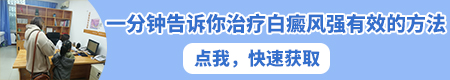 边界不明显的白斑是什么 能避免白斑长大吗