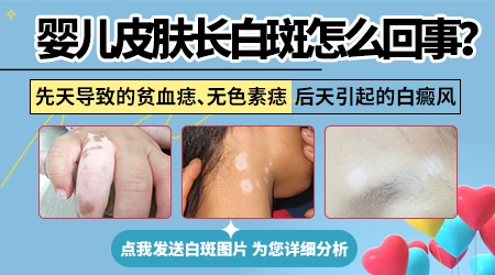 孩子刚出生腿上一块白