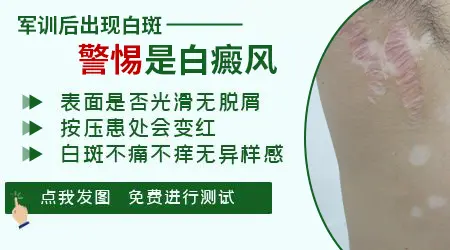 军训后孩子后背长了小白点