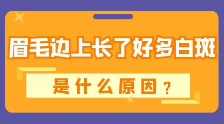 引起眉毛里有白斑的原因