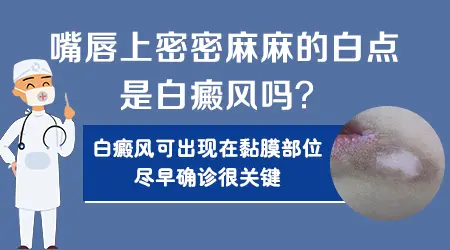 嘴角长白斑是怎么回事