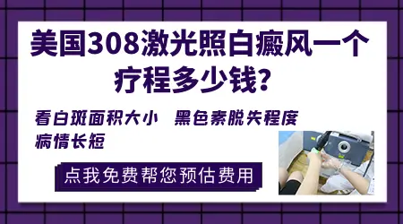 308激光可以治疗婴儿白癜风吗