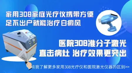 家用308准分子激光治疗仪买什么类型的