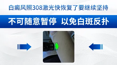 照了308激光白斑逐渐好转图片