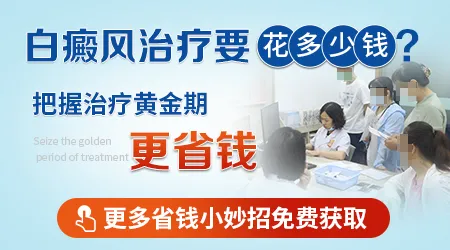 白癜风做激光给报销吗