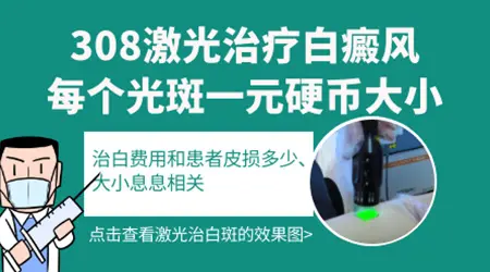 进口308激光仪器多少钱