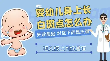 婴幼儿白癜风能治好吗