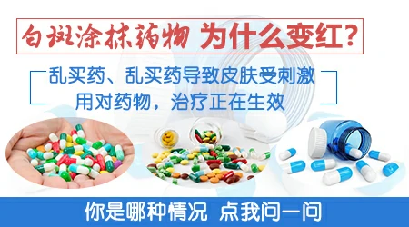 白癜风用药后发痒发红是好还是不好