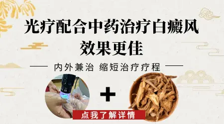 中药治白癜风不照光行吗