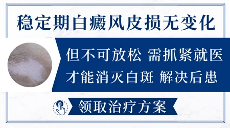 白癜风多年没扩散还有必要治吗