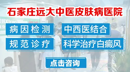 石家庄医院治疗白斑怎么样