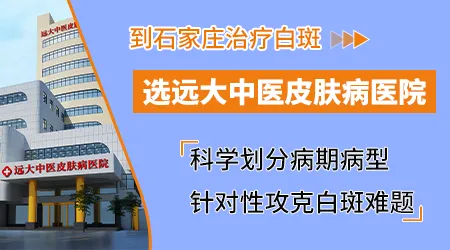 石家庄治疗白癜风效果如何