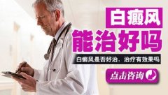 腰部白癜风抹什么药治疗比较好