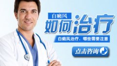 我想试试药方治疗白癜风有没有效果